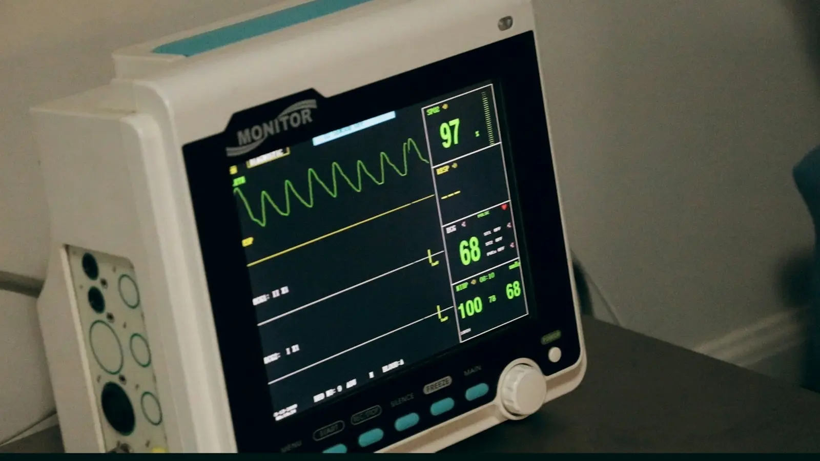 A hospital monitor displaying vital signs with a green waveform